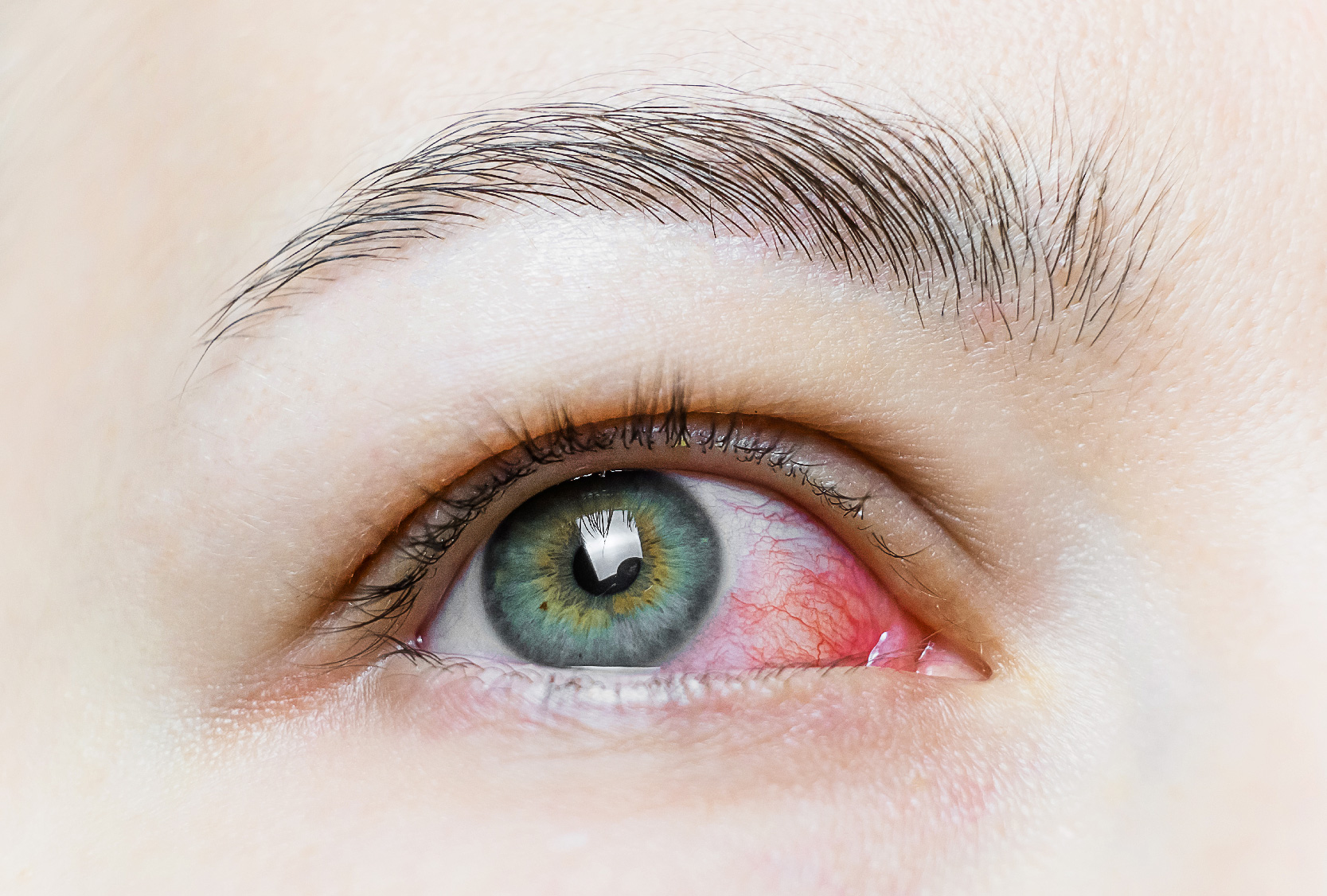 Eye Allergies What You Need To Know Whoosh! To Whoosh Eyewear